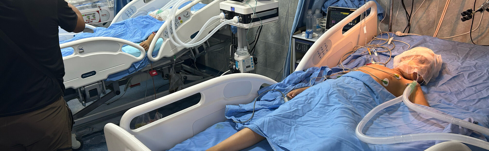 A child receives treatment at Kamal Adwan Hospital’s Intensive Care Unit in North Gaza. Photo by OCHA